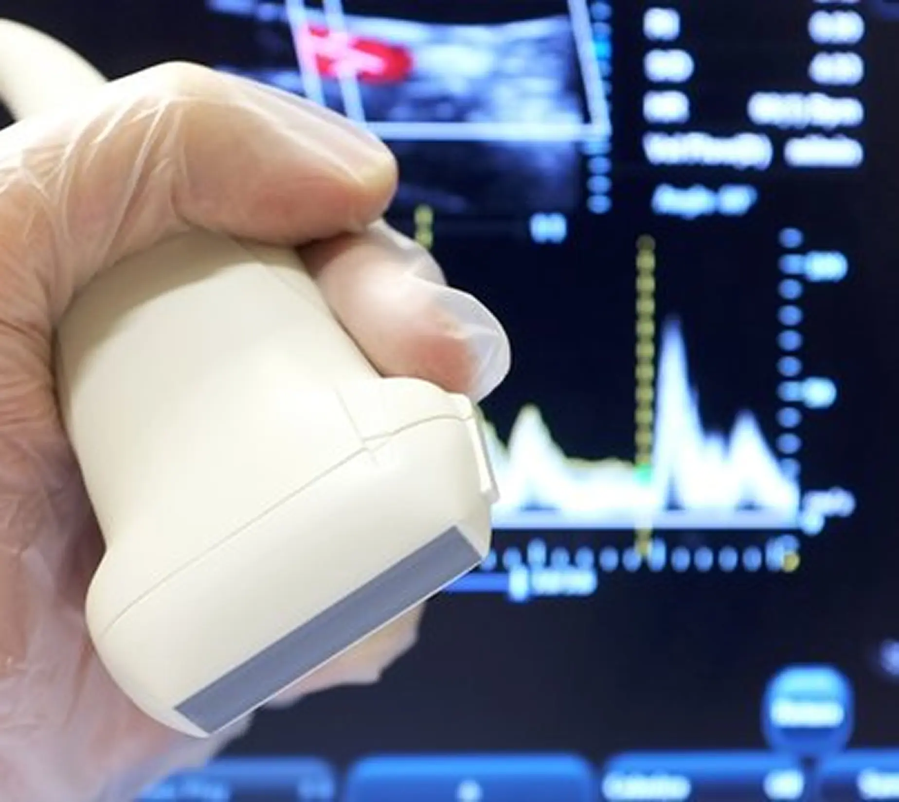 ultrasound transducer