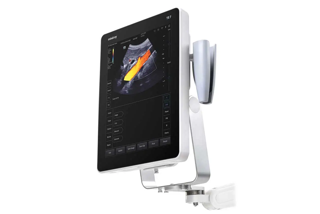 Close-up of Mindray TE5 control panel and touchscreen interface with customizable settings