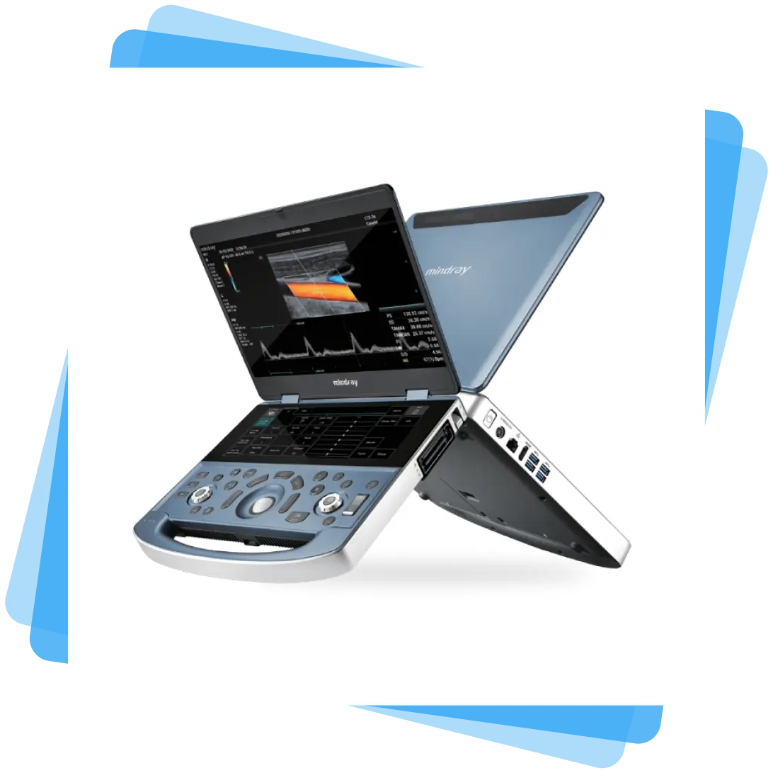 Pre-owned Mindray MX7 portable ultrasound machine available for sale with warranty and support