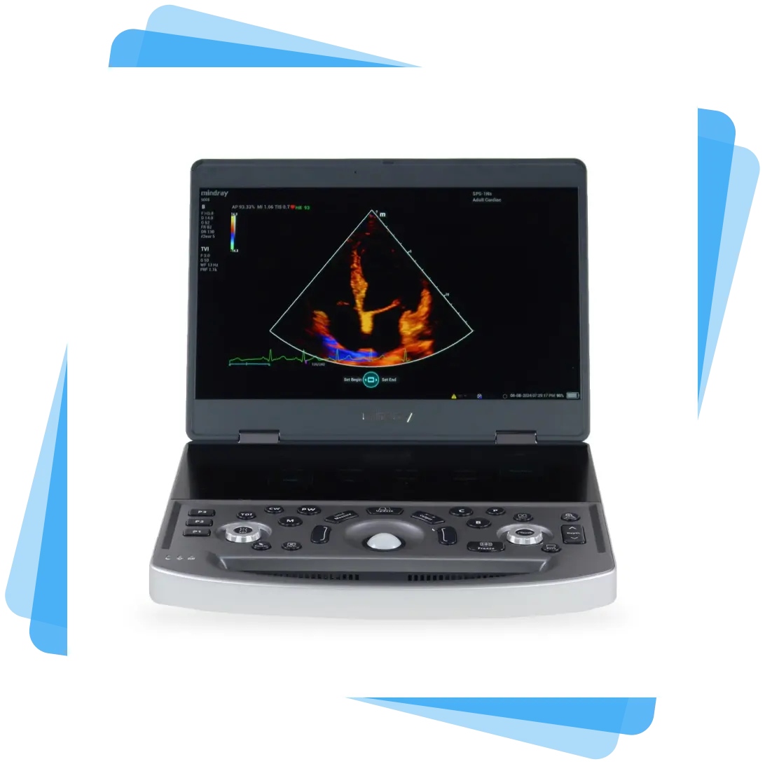 Musculoskeletal ultrasound mode on Mindray MX8 with enhanced needle visualization using iNeedle+ and ZST+ imaging technology