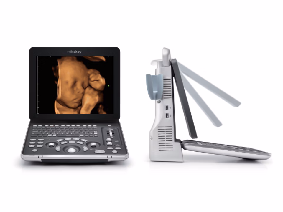Mindray Z60 displaying cardiac ultrasound imaging with color Doppler and Auto IMT functionality