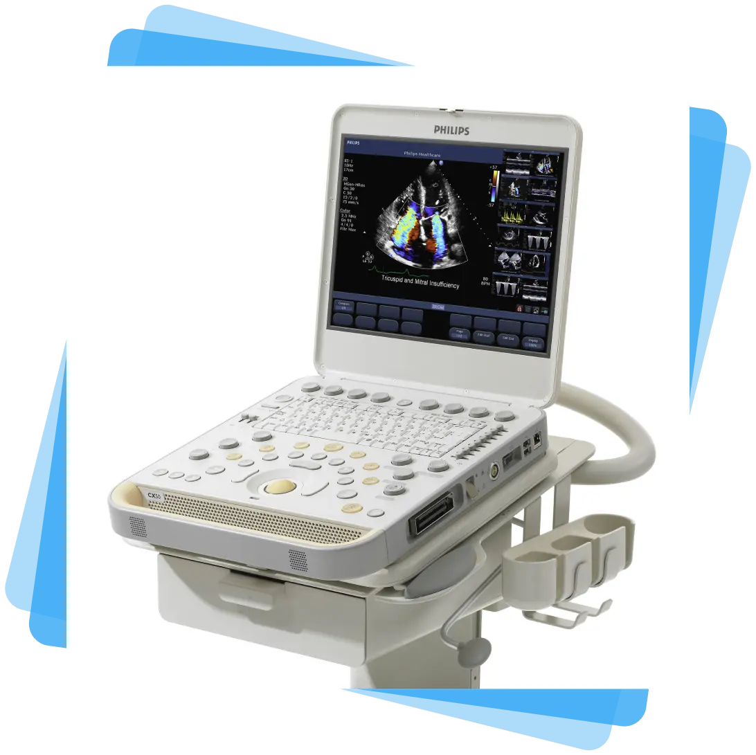 Philips CX50 portable ultrasound system mounted on original Philips cart for mobility
