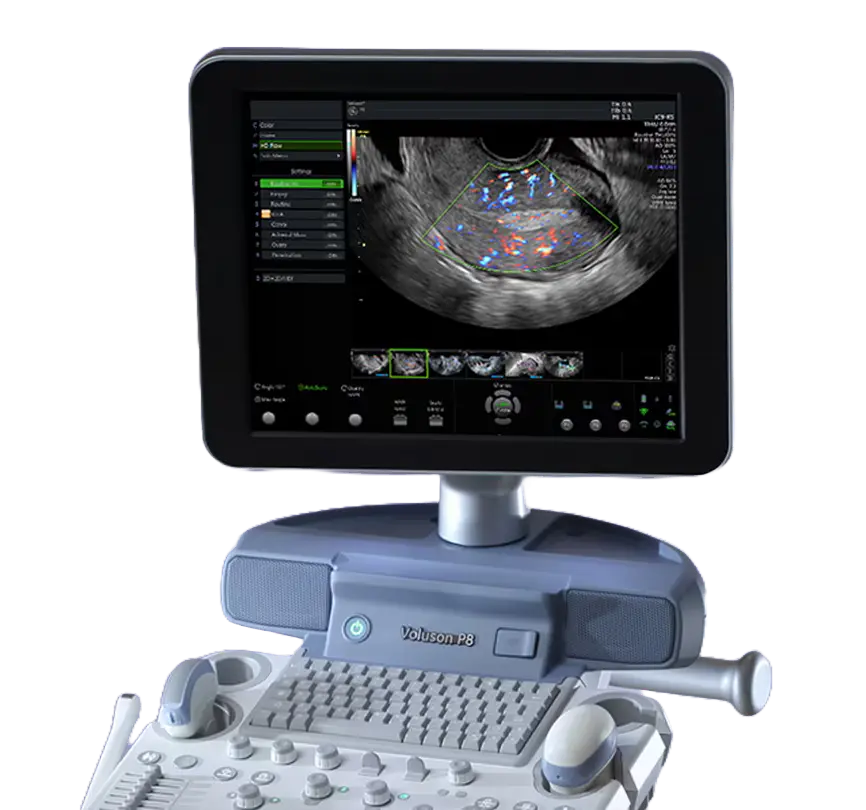 3D/4D fetal imaging scan on GE Voluson P8 showing realistic fetal anatomy using advanced HDlive and SonoRenderlive technologies