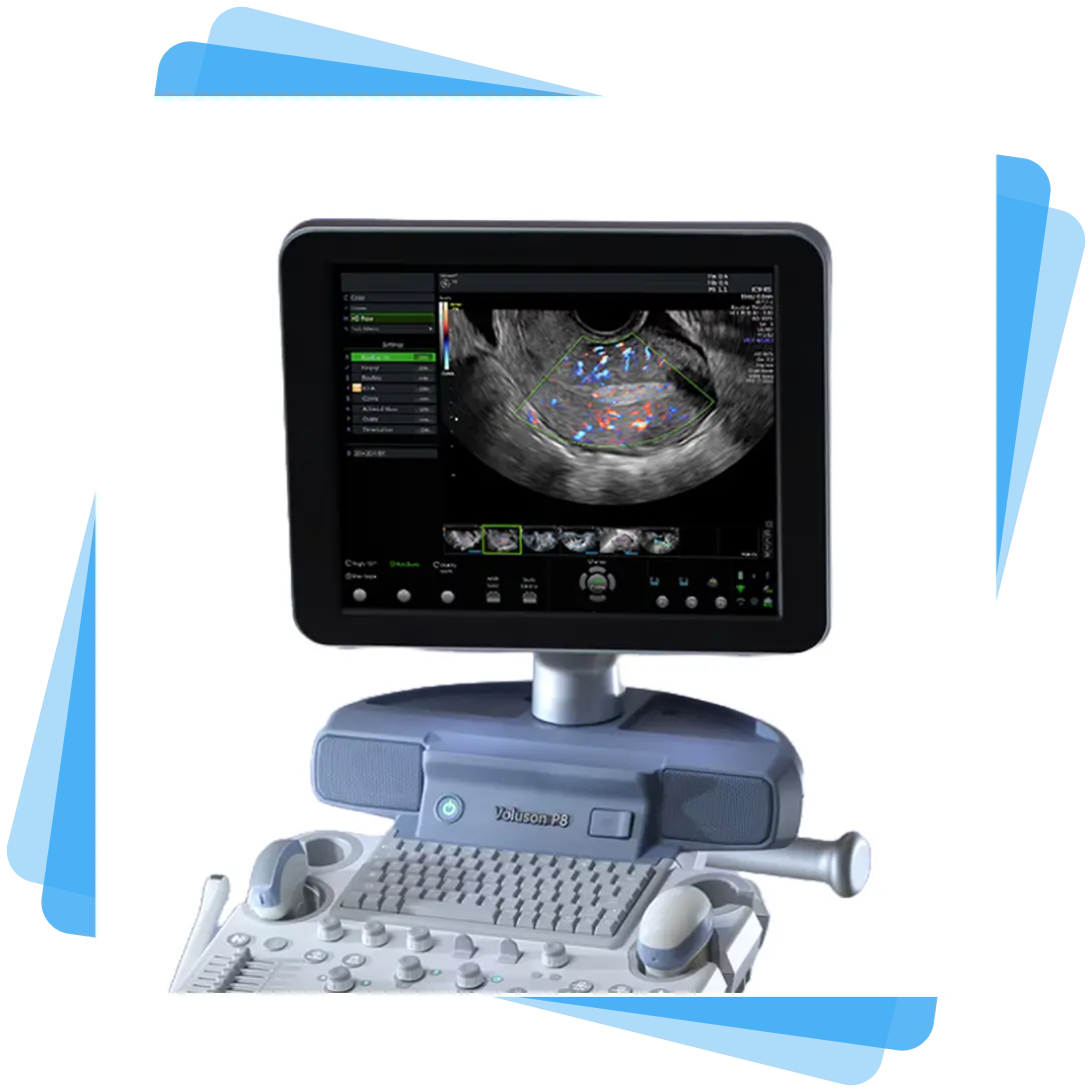 Close-up of GE Voluson P8 monitor and control panel with customizable keys, trackball navigation, and soft-touch interface for improved workflow