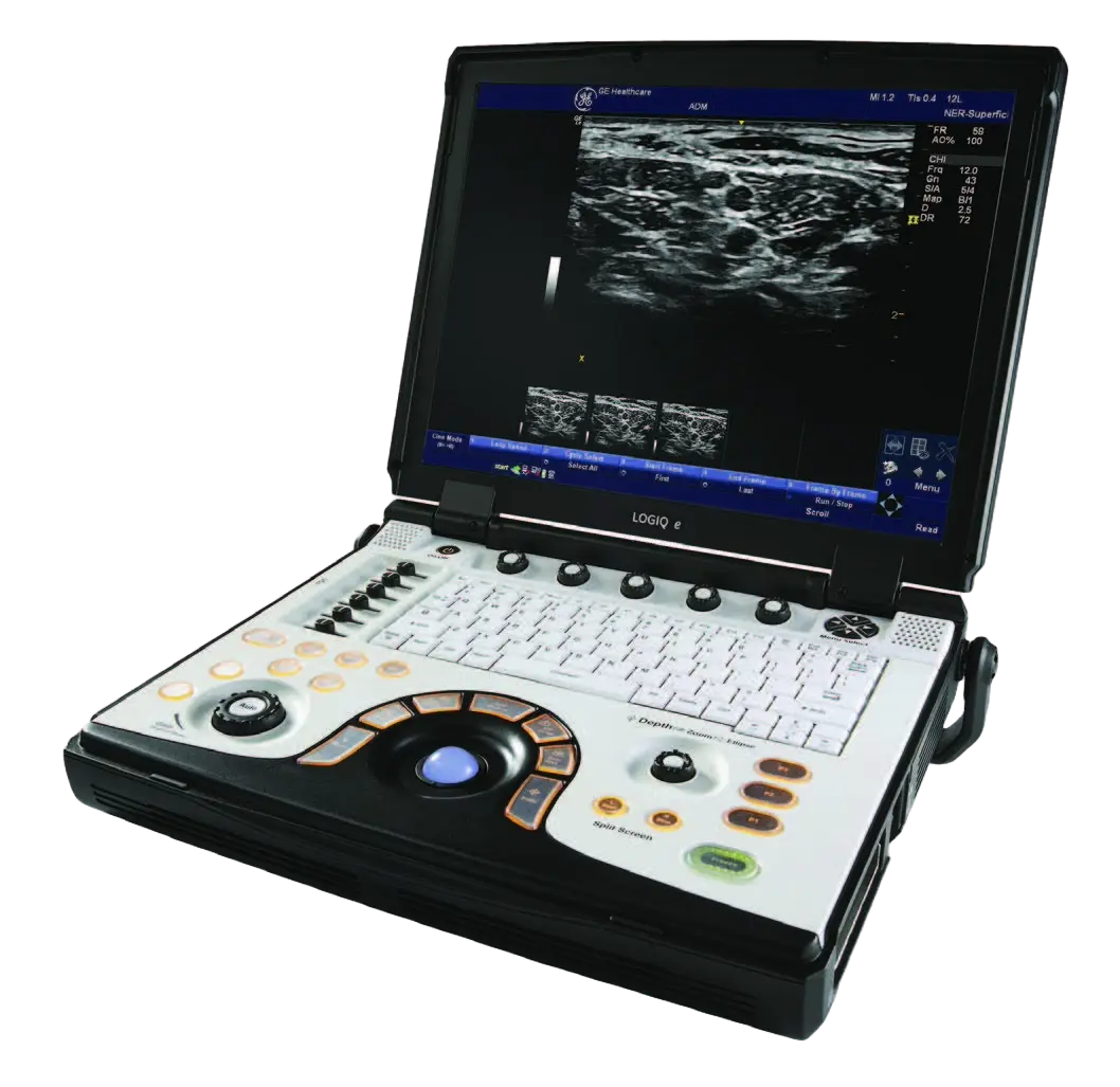 Front view of GE NextGen LOGIQ e R8 portable ultrasound machine with 15-inch HD LCD monitor, ergonomic control panel, and compact lightweight design