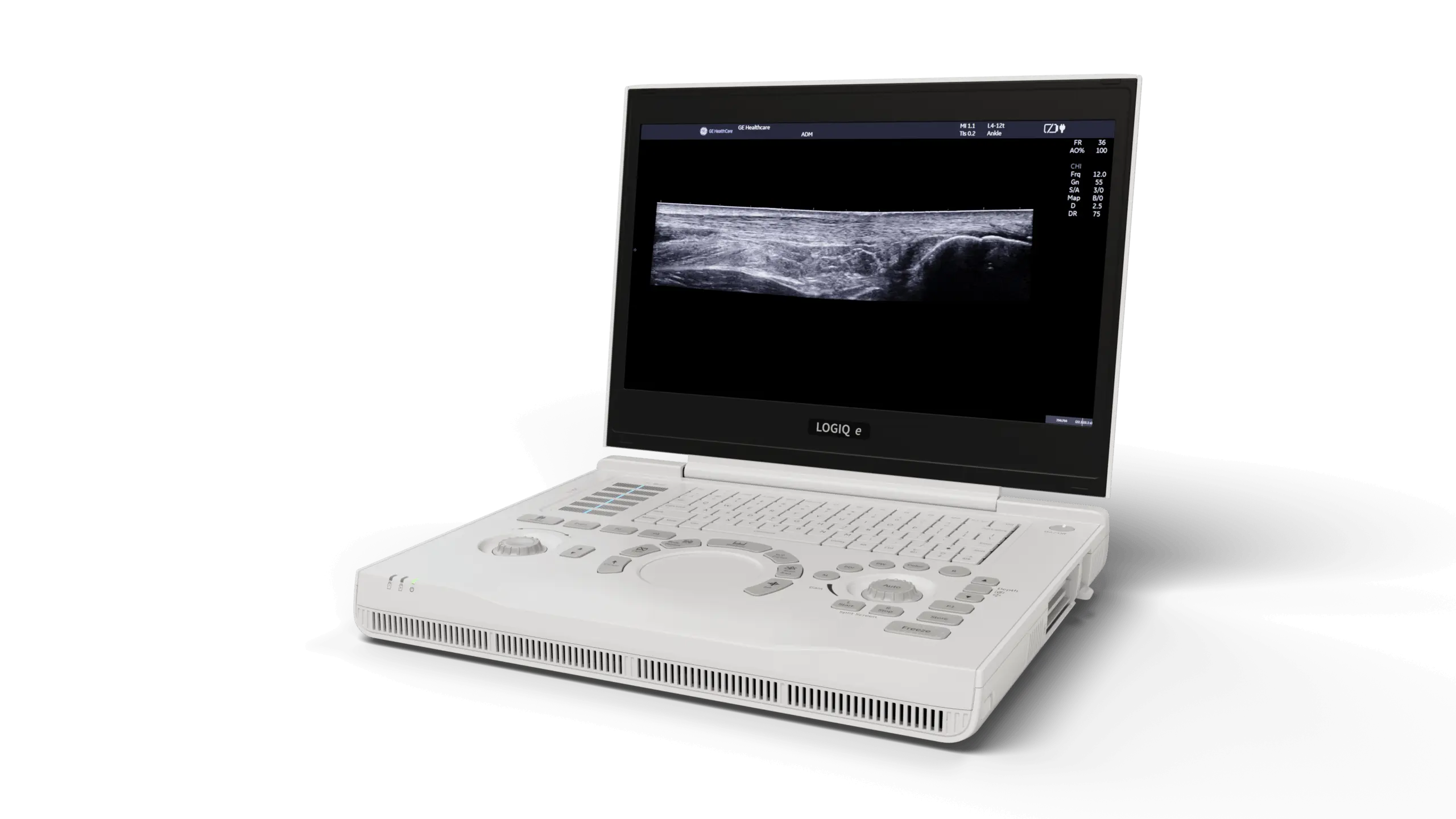 Refurbished GE NextGen LOGIQ e R9 Portable Ultrasound Machine