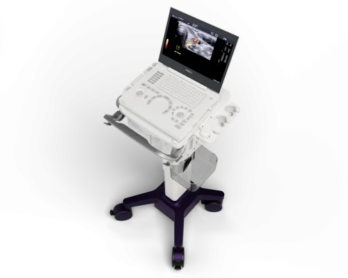 Doctor evaluating joint inflammation using Strain Elastography on GE LOGIQ e R9 ultrasound