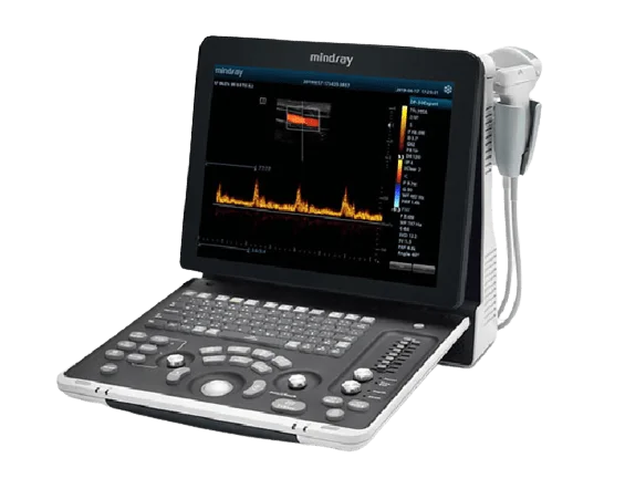 mindray_dp-50_expert_left_view_for_sale-tuss