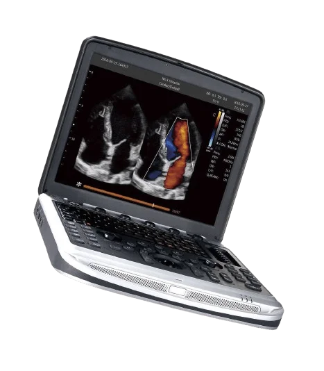 chison-sonobook9-left-angled_for-sale-tuss