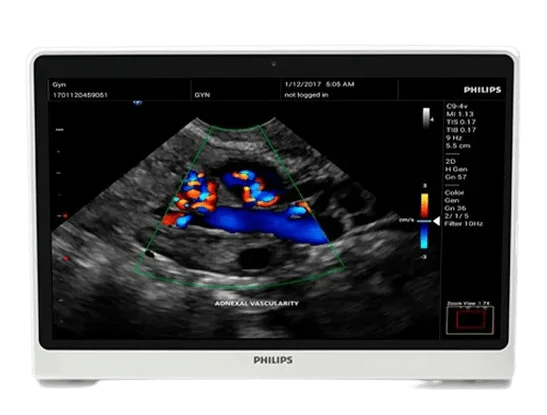 Philips-Innosight-tuss