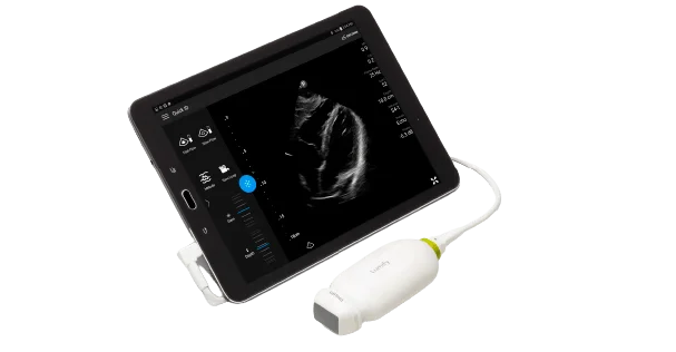 Philips-lumify-tuss
